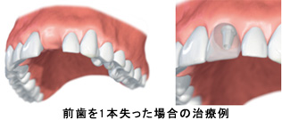 従来の治療法との違い