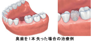 従来の治療法との違い