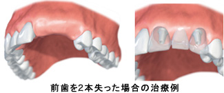 従来の治療法との違い