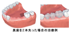 従来の治療法との違い