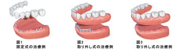 従来の治療法との違い