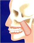 顎関節症